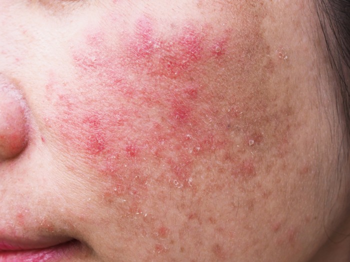 Principales patologías de la piel que debes conocer si estudias estética