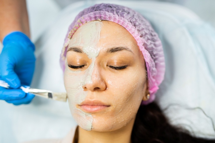 tipos de peeling facial en puerto rico 2025